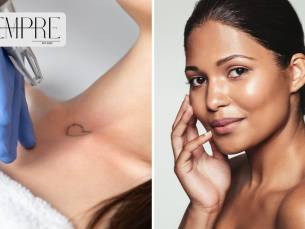 Chemische peeling of tattoo verwijderen