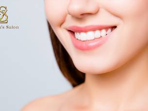 Tandenbleekbehandeling naar keuze bij Zehra's Salon