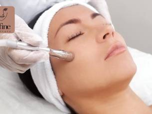 Microdermabrasie-behandeling