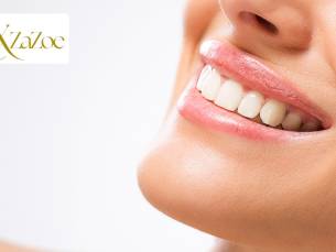 Tandenbleekbehandeling naar keuze