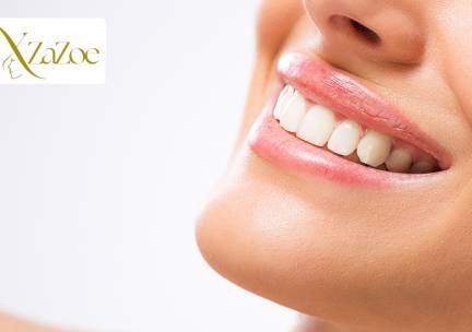 Tandenbleekbehandeling naar keuze