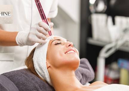 Microneedling-behandeling naar keuze