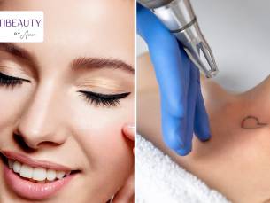 PMU naar keuze laten zetten of PMU of tatoeage laten verwijderen