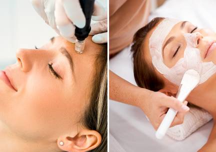 Microneedling, chemical peeling of enzympeeling (30 of 60 min)