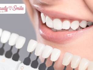 2, 4 of 6 tandenbleekbehandelingen