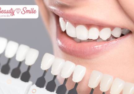 2, 4 of 6 tandenbleekbehandelingen