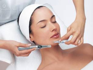 1 of 2 microneedling-behandeling(en) naar keuze (45 of 60 min)