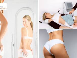 Afslankbehandeling naar keuze