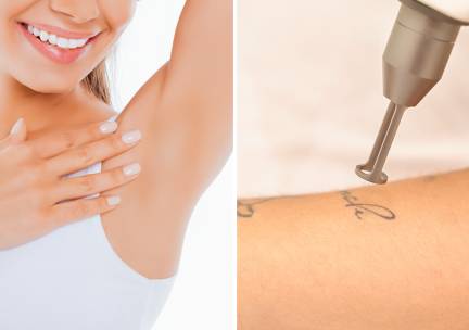 6 laser-ontharingsbehandelingen voor zone naar keuze of tattoo verwijderen