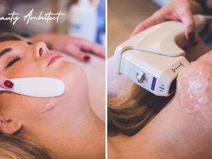Microneedling of HIFU-behandeling