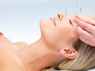 Acupunctuurbehandeling (45 min)