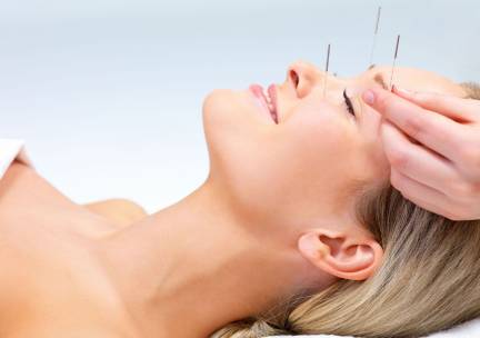 Acupunctuurbehandeling (45 min)