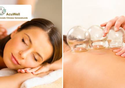 Ontspanningsmassage en/of cupping (30 of 60 min)