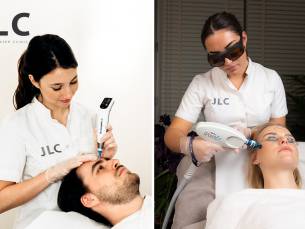 Microneedling voor zone naar keuze + evt. laserbehandeling