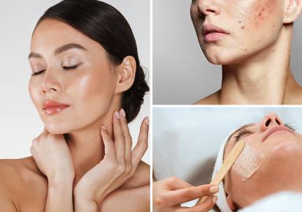 Gezichts- of acnebehandeling naar keuze (45 of 60 min)