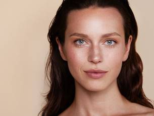 1 of 3 microneedling-behandeling(en)