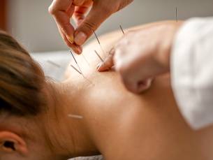 Acupunctuurbehandeling + intake (60 min)
