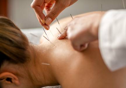 Acupunctuurbehandeling + intake (60 min)