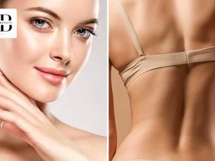 1 of 3 carbon laser peeling-behandeling(en)