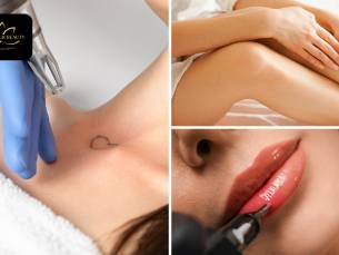 Carbon laser peeling of PMU of tatoeage verwijderen