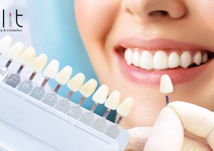 2 tot 6 tandenbleekbehandeling(en)