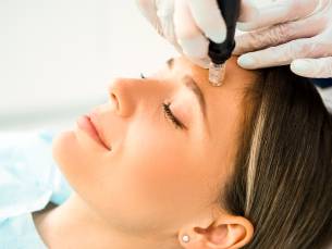 Microneedling-behandeling + led-lichttherapie (75 min)