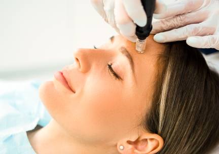 Microneedling-behandeling + led-lichttherapie (75 min)