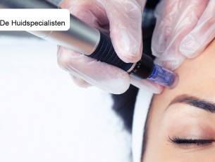 1, 4 of 6 basis of luxe microneedling-behandeling(en)