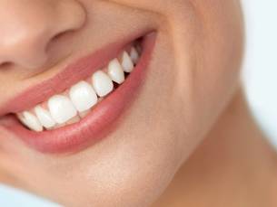 3, 4 of 5 sessies tandenbleken