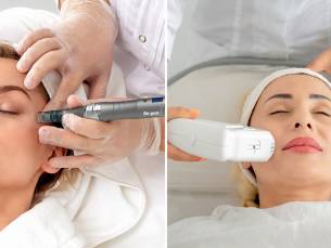 1 of 3 microneedling- of HIFU-behandeling(en) voor een zone naar keuze