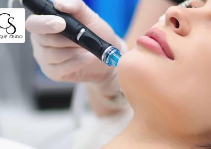 Microneedling en/of hydrofacial