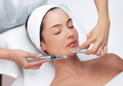 1 of 2 microneedling-behandeling(en) naar keuze (45 of 60 min)