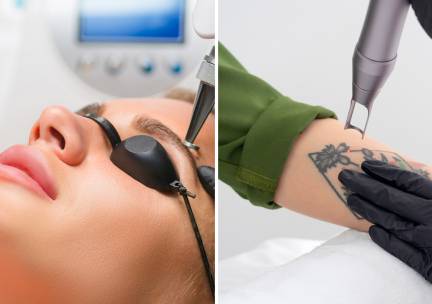 Tatoeage of PMU verwijderen
