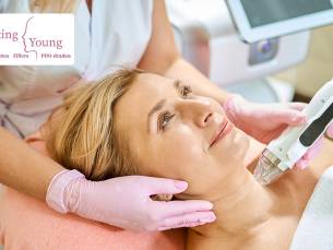 1 of 3 microneedling-behandeling(en) (50 min)
