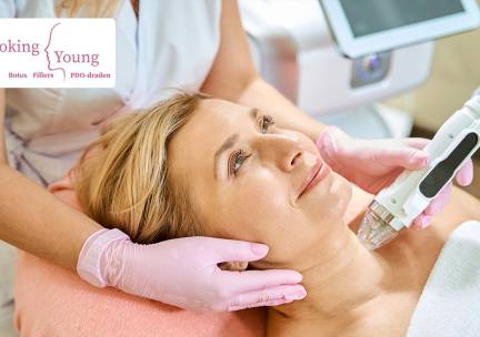 1 of 3 microneedling-behandeling(en) (50 min)