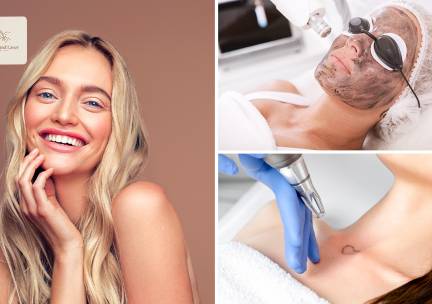 Carbon peeling of tatoeage verwijderen