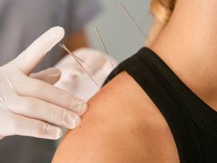 Acupunctuurbehandeling (60 min)