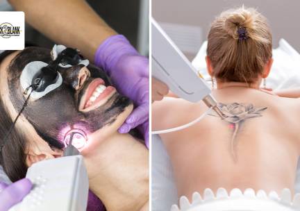 Carbon peeling voor een zone naar keuze of tatoeage verwijderen (tot 35 cm)