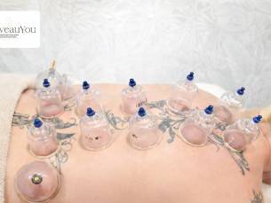 Cuppingbehandeling naar keuze (45, 60 of 90 min)