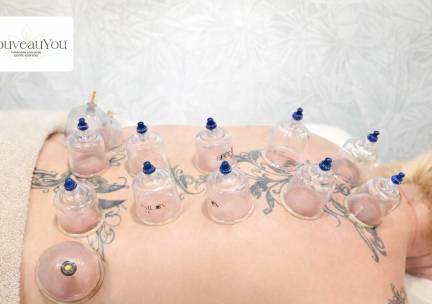 Cuppingbehandeling naar keuze (45, 60 of 90 min)