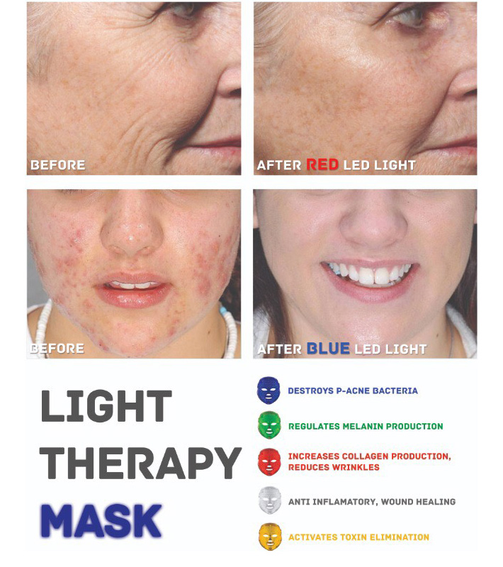 LED Light Therapy Mask Gosawa Beirut Deal