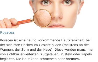 https://s3-eu-west-1.amazonaws.com/docomimg2.s3.amazonaws.com/campagne/2016/wk15/DE/huid5.jpg