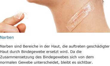 https://s3-eu-west-1.amazonaws.com/docomimg2.s3.amazonaws.com/campagne/huid/DE/huid44.jpg