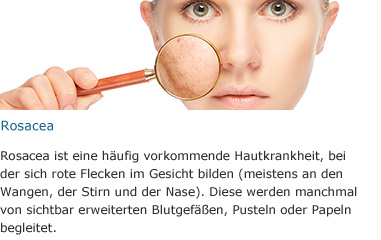 https://s3-eu-west-1.amazonaws.com/docomimg2.s3.amazonaws.com/campagne/huid/DE/huid55.jpg