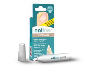 Nailner repair
