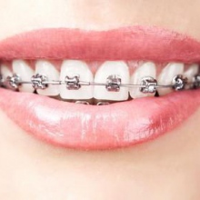 Ingrandire l'immagine: Ferdinando Mengoni, dentista Vasto