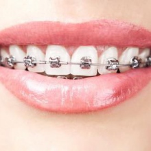 Ingrandire l'immagine: Alessandro Marchese, dentista Marcon-Gaggio-Colmello