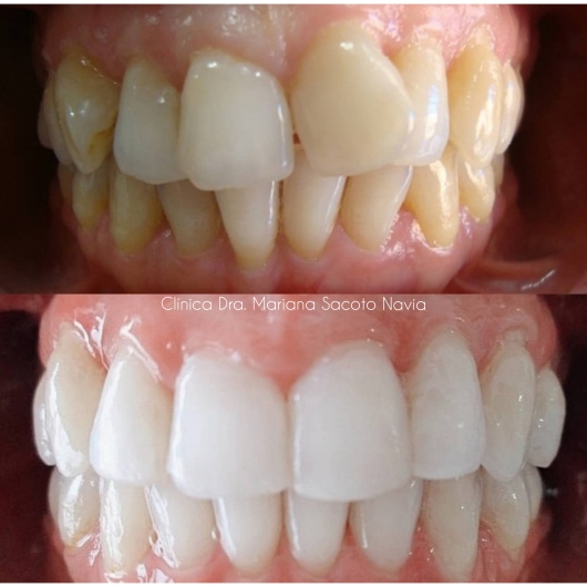 Mariana Sacoto Navia-3