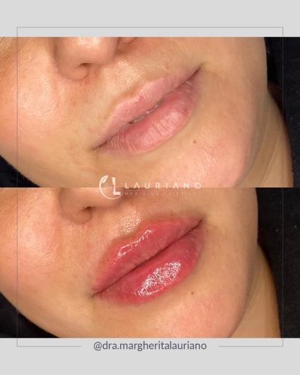 Margherita Lauriano-8