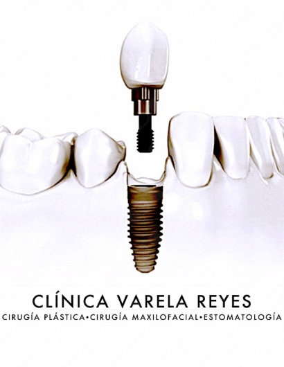 Alejandro Encinas Bascones-2